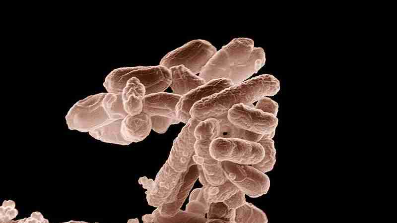 b E coli at, tags: ausbruch von e. - upload.wikimedia.org