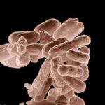 b E coli at, tags: ausbruch von e. - upload.wikimedia.org